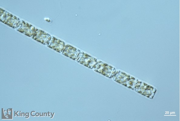 Photo of Cerataulina pelagica